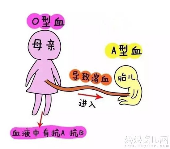 abo溶血癥的孩子能要嗎,關于abo溶血癥的孩子能否要以及穩(wěn)定計劃評估的思考,數據支持方案設計_Windows63.25.66