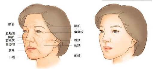 自體脂肪填充淚溝能保持幾年,自體脂肪填充淚溝的效果持久性與數(shù)據(jù)資料解析,數(shù)據(jù)支持計(jì)劃解析_鵠版12.77.91