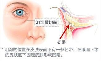 自體脂肪填充淚溝會移位嗎,自體脂肪填充淚溝會移位嗎？穩(wěn)定評估計劃及ChromeOS 41.47.93的輔助作用,全面數(shù)據(jù)策略實施_Chromebook28.28.48