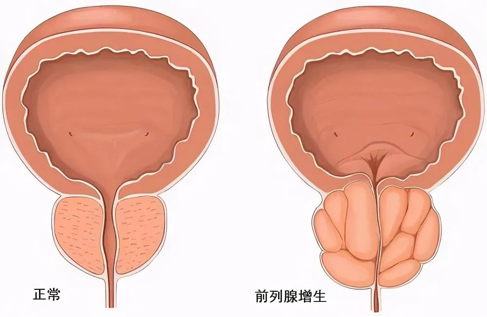 前列腺病有什么癥狀表現(xiàn),前列腺病的癥狀表現(xiàn)及靈活操作方案,數(shù)據(jù)分析驅(qū)動解析_DX版22.26.15