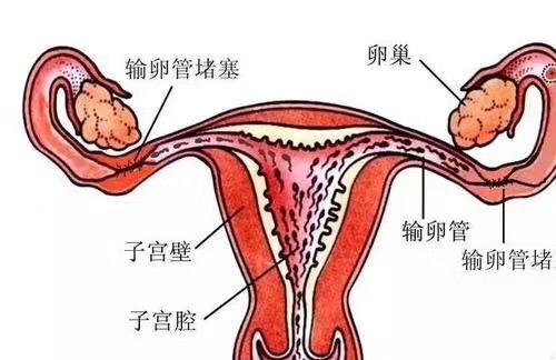 輸卵管不孕的最佳治療方法與高速方案規(guī)劃——領(lǐng)航款48.13.17，迅速處理解答問題_C版27.663