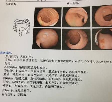 盆腔炎最明顯的三種征兆腸道有息肉,關(guān)于盆腔炎、腸道息肉及其相關(guān)征兆的快速解答設(shè)計——ChromeOS 90.44.97環(huán)境下的健康管理指南,社會責(zé)任方案執(zhí)行_挑戰(zhàn)款38.55