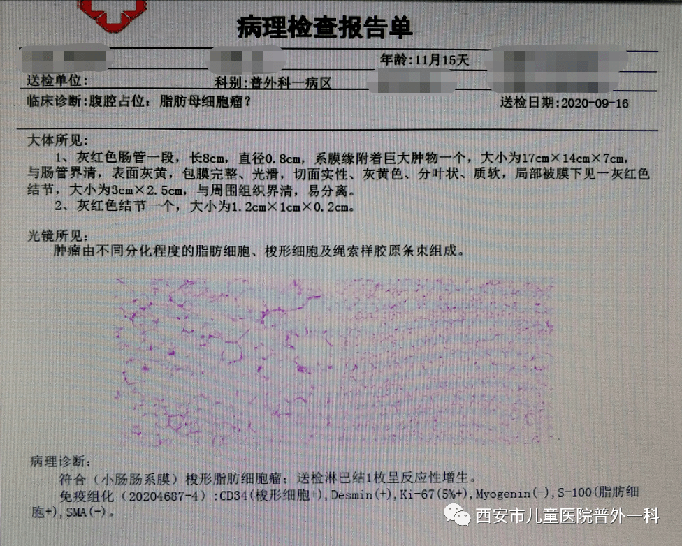 女子腫瘤復(fù)發(fā)三次腹部積液近百斤迅速執(zhí)行計(jì)劃設(shè)計(jì)_凹版56.80.65